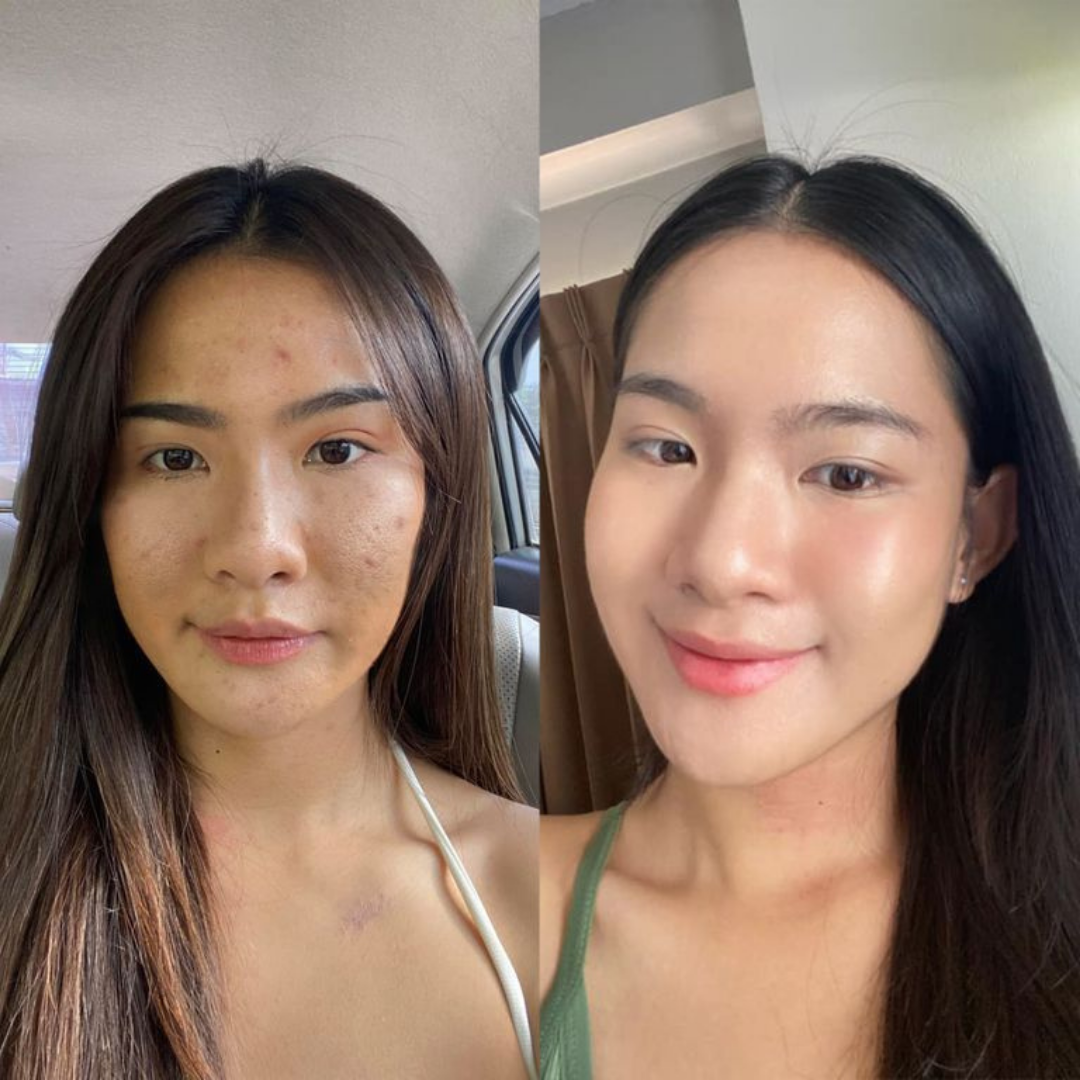 ⭐⭐Combo Serum de Esperma de Salmon + Capsulas de Colágeno🐠(PDRN) El Secreto Coreano🇰🇷 que está Revolucionando la Belleza💫