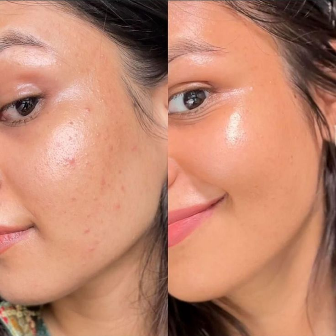 ⭐⭐Combo Serum de Esperma de Salmon + Capsulas de Colágeno🐠(PDRN) El Secreto Coreano🇰🇷 que está Revolucionando la Belleza💫